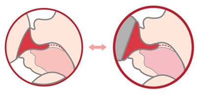 Baby PPSU Anti-colic Bottle